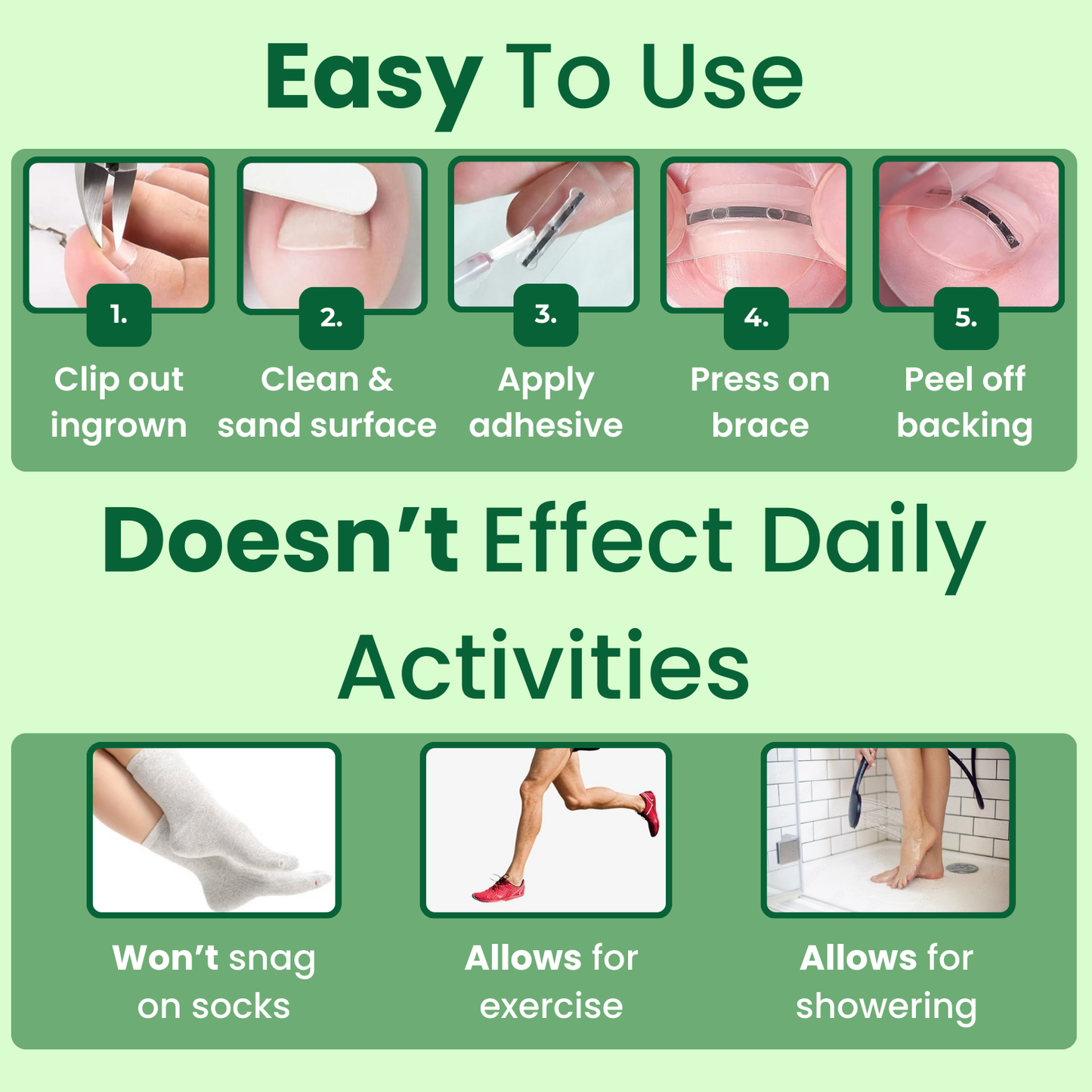 Ingrown Toenail Home Relief Treatment Kit