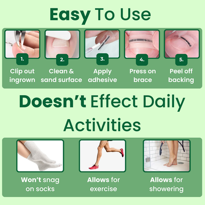 Ingrown Toenail Home Relief Treatment Kit