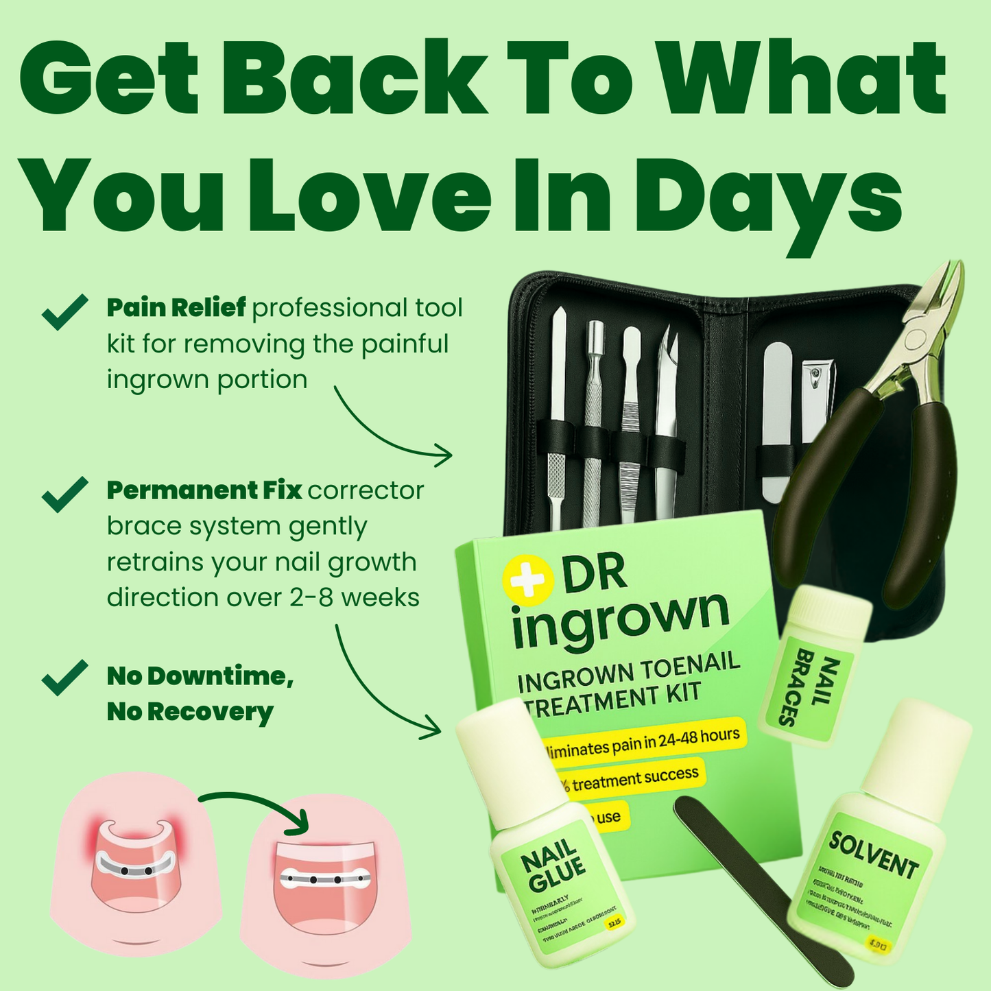 Ingrown Toenail Home Relief Treatment Kit