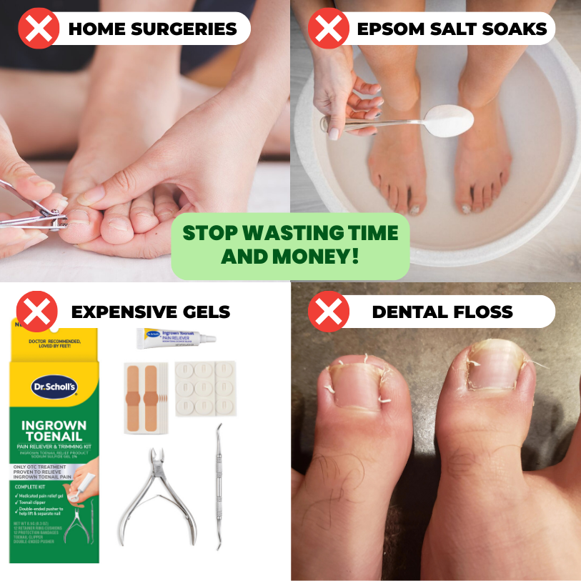 Ingrown Toenail Home Relief Treatment Kit