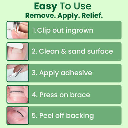 Ingrown Toenail Home Relief Treatment Kit